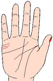 ������ͼ��1