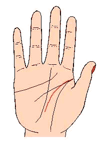 �ǻ��߹�������