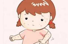 梦见抓挠 做梦梦见抓挠是什么预兆 梦见抓挠好不好